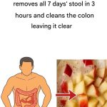 Constipation: Here are 3 natural remedies that ease intestinal transit, according to a dietitian.