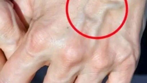 If you have visible veins, this means that you…