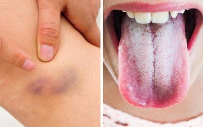 11 signs that your body is giving you important warnings
