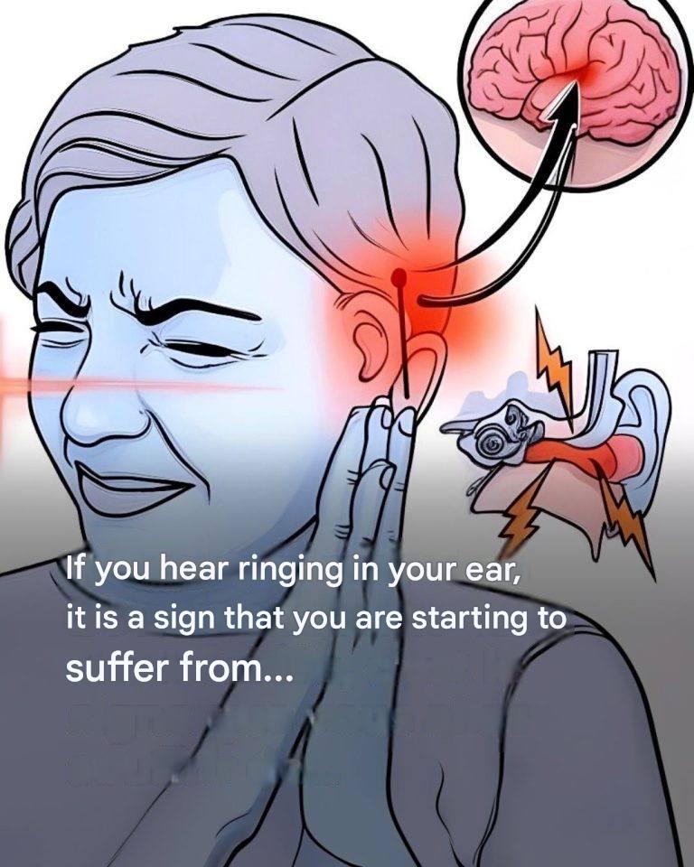 Ringing in Your Ears: Your Body’s Surprising Explanation