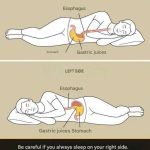 Remember that if you always sleep on your right side, you… Read more