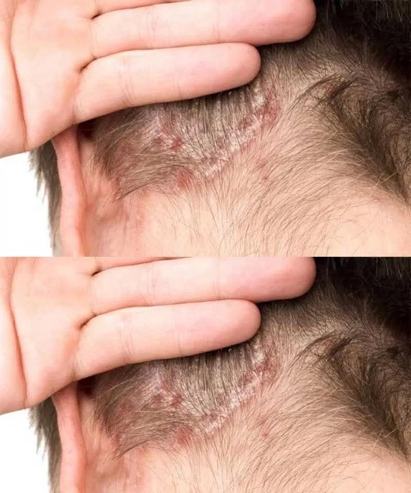 I found this on my son’s scalp. I have no idea what it is and we can’t get a doctor’s appointment right now. Do you have any advice?