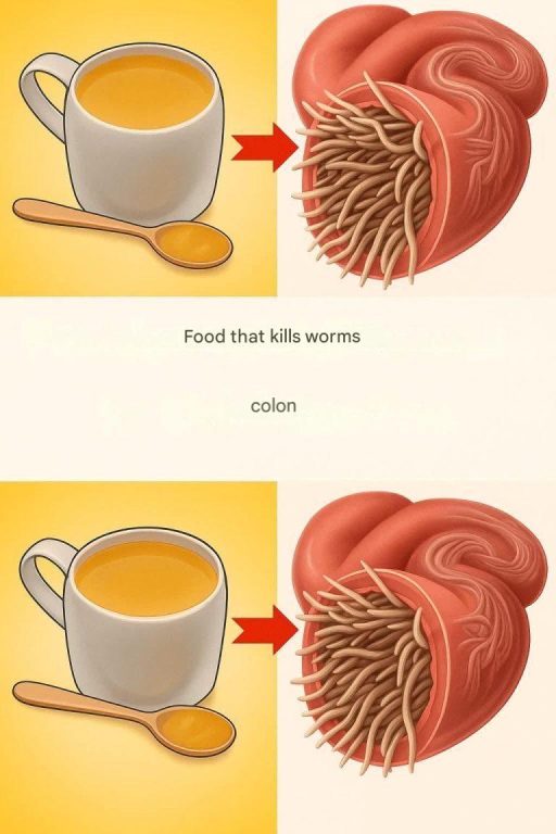 7 foods that kill intestinal worms
