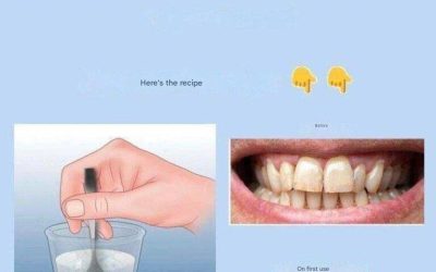 Remove tartar and whiten your teeth with this simple recipe.