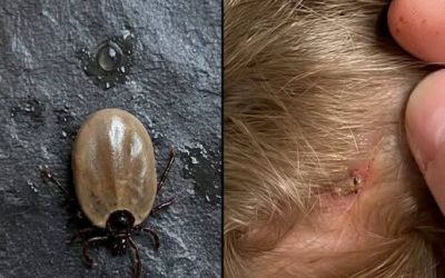 Does anyone know what kind of insect this is? I found it on my son’s head…