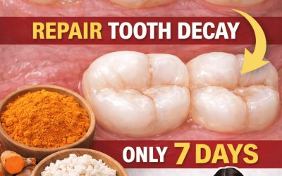 100% Natural Home Remedy for Tooth Decay, Yellow Teeth, and Tooth Pain