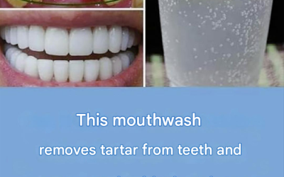 A natural method to remove plaque