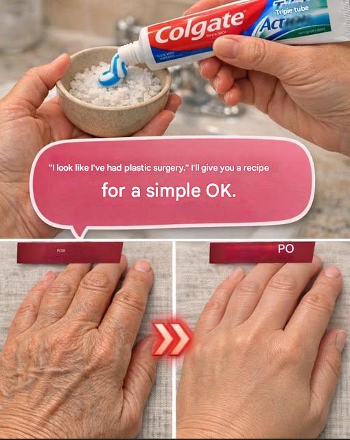 “It looks like I’ve had plastic surgery”: a home remedy to reduce wrinkles and discoloration on hands and arms. To continue receiving my recipes, you can subscribe… Thank you!