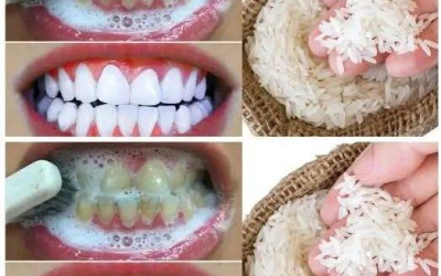 “I tried this 1-minute trick with ingredients I had in my kitchen… The result: My teeth became instantly whiter.”