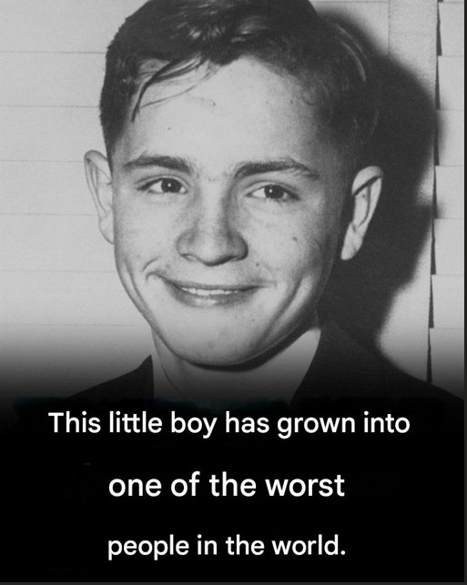 This hairless boy grew up to be one of the worst people in history! – Story of the day!