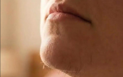 Why chin hair can develop in women and simple ways to keep it under control
