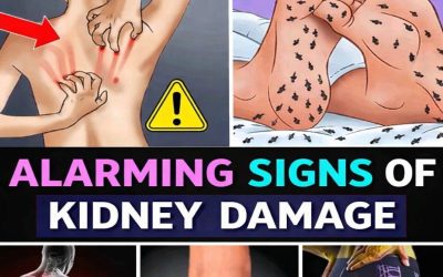 15 Deadly Kidney Signs You Must Catch Early