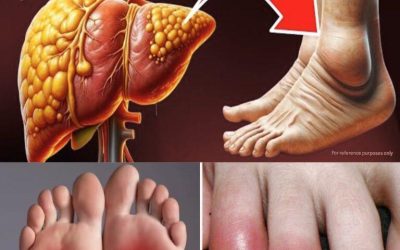 12 Foot Symptoms That May Indicate a Liver Problem