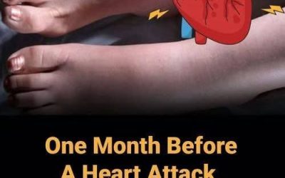 One Month Before A Heart Attack, Your Feet Will W.arn You Of These 6 Signs