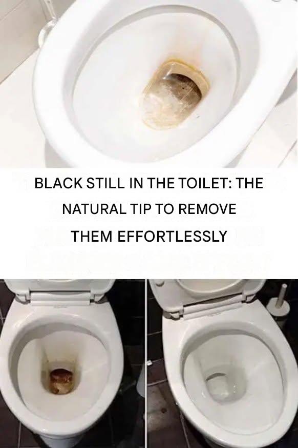 Blackened toilets: the miracle (and natural) solution to get rid of those stubborn stains