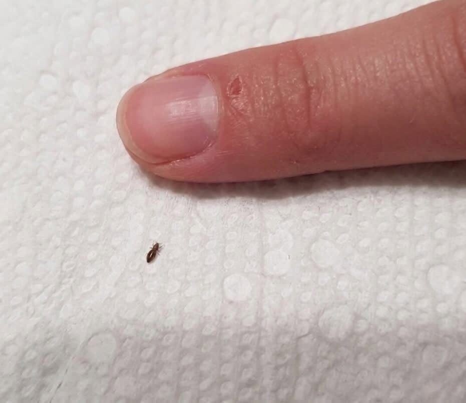 ”Wife found this in our toddler’s hair. Anything we should worry about? He goes to daycare 3 times a week.
