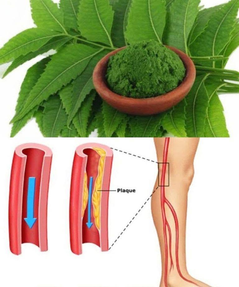 1 Leaf that helps destroy DIABETES, BLOOD PRESSURE, eliminate BODY PAIN, cholesterol and eliminate POOR CIRCULATION.