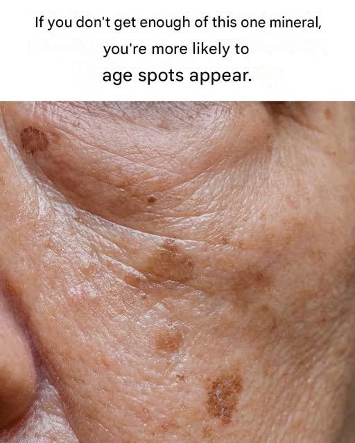 The One Mineral Your Skin Desperately Craves—Without It, Age Spots Proliferate Quickly The One Mineral Your Skin Desperately Craves—Without It, Age Spots Proliferate Quickly