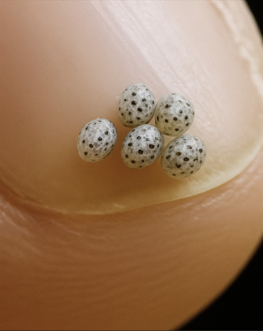 We ordered salad, but there were small black spots on the food: they took us to the hospital immediately.