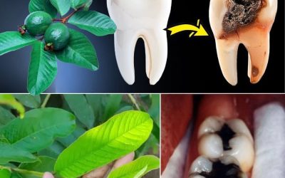 Top 3 Ways to Treat Tooth Decay with Guava Leaves – Simple and Cost-Effective