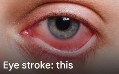 Eye stroke: this symptom can cause you to lose your sight in a few hours
