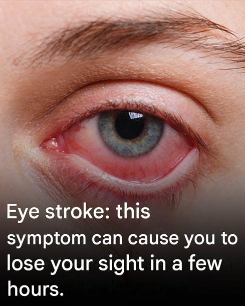 Eye stroke: this symptom can cause you to lose your sight in a few hours