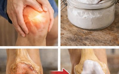 Are You Ignoring Knee Pain? Simple Food Habits That Support Joint Health