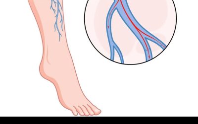 Top 5 vitamins to supercharge circulation in your legs & feet