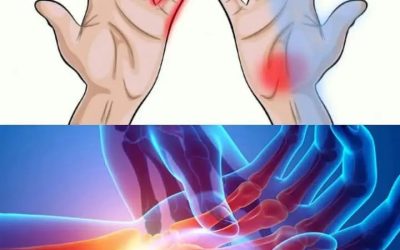 7 Things Your Hands Can Tell You About Your Health