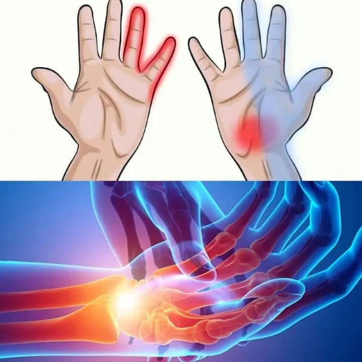 7 Things Your Hands Can Tell You About Your Health