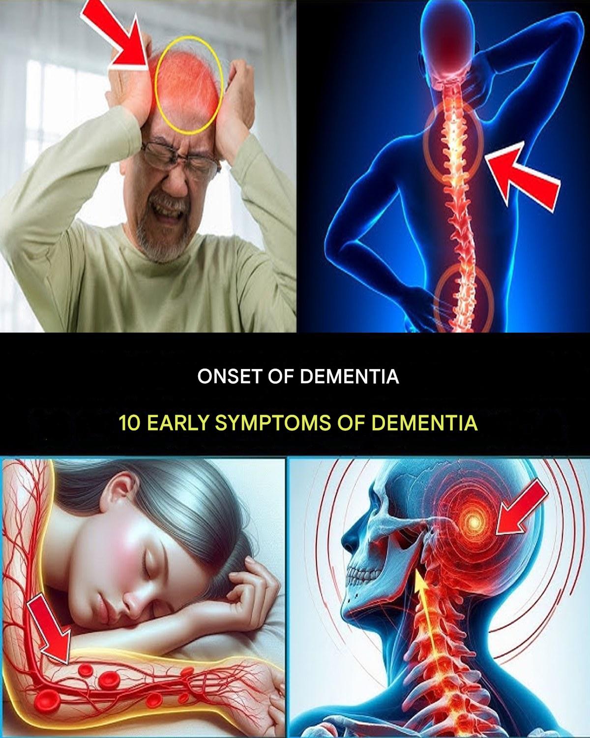 7 EARLY SYMPTOMS OF ALZHEIMER’S DISEASE THAT SHOULD NEVER BE IGNORED!